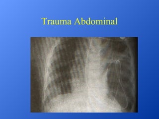 Trauma Abdominal

 