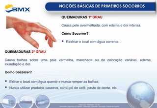 QUEIMADURAS 1º GRAU
Causa pele avermelhada, com edema e dor intensa.
Como Socorrer?
▪ Resfriar o local com água corrente.
QUEIMADURAS 2º GRAU
Causa bolhas sobre uma pele vermelha, manchada ou de coloração variável, edema,
exsudação e dor.
Como Socorrer?
▪ Esfriar o local com água quente e nunca romper as bolhas;
▪ Nunca utilizar produtos caseiros, como pó de café, pasta de dente, etc.
NOÇÕES BÁSICAS DE PRIMEIROS SOCORROS
Elaboração: 18/04/2022 - Rev.00
Elaboração: Segurança do Trabalho - Verificação: Qualidade - Aprovação: Diretoria de Suporte
 