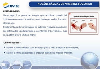 HEMORRAGIAS
Hemorragia é a perda de sangue que acontece quando há
rompimento de veias ou artérias, provocadas por cortes, tumores,
úlceras, etc.
Existem 2 tipos de hemorragias, as externas (visíveis) que devem
ser estancadas imediatamente e as internas (não visíveis), mas
que podem levar a vítima à morte.
NOÇÕES BÁSICAS DE PRIMEIROS SOCORROS
Elaboração: 18/04/2022 - Rev.00
Elaboração: Segurança do Trabalho - Verificação: Qualidade - Aprovação: Diretoria de Suporte
Como socorrer?
▪ Manter a vítima deitada com a cabeça para o lado e afrouxar suas roupas;
▪ Manter a vítima agasalhada e procurar assistência médica imediata.
 