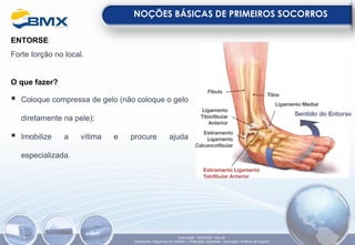ENTORSE
Forte torção no local.
O que fazer?
▪ Coloque compressa de gelo (não coloque o gelo
diretamente na pele);
▪ Imobilize a vítima e procure ajuda
especializada.
NOÇÕES BÁSICAS DE PRIMEIROS SOCORROS
Elaboração: 18/04/2022 - Rev.00
Elaboração: Segurança do Trabalho - Verificação: Qualidade - Aprovação: Diretoria de Suporte
 