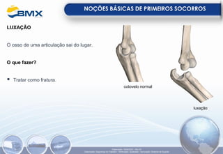 LUXAÇÃO
O osso de uma articulação sai do lugar.
O que fazer?
▪ Tratar como fratura.
NOÇÕES BÁSICAS DE PRIMEIROS SOCORROS
cotovelo normal
luxação
Elaboração: 18/04/2022 - Rev.00
Elaboração: Segurança do Trabalho - Verificação: Qualidade - Aprovação: Diretoria de Suporte
 