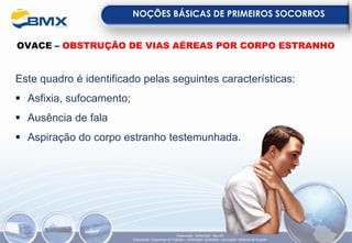 NOÇÕES BÁSICAS DE PRIMEIROS SOCORROS
Elaboração: 18/04/2022 - Rev.00
Elaboração: Segurança do Trabalho - Verificação: Qualidade - Aprovação: Diretoria de Suporte
OVACE – OBSTRUÇÃO DE VIAS AÉREAS POR CORPO ESTRANHO
Este quadro é identificado pelas seguintes características:
▪ Asfixia, sufocamento;
▪ Ausência de fala
▪ Aspiração do corpo estranho testemunhada.
 