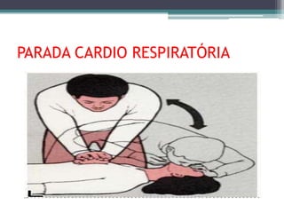 PARADA CARDIO RESPIRATÓRIA
 