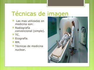 Técnicas de imagen
 Las mas utilizadas en
medicina son:
 Radiografía
convencional (simple).
 TC.
 Ecografía.
 RM.
 T...