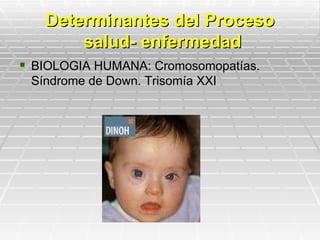 Determinantes del Proceso
       salud- enfermedad
 BIOLOGIA HUMANA: Cromosomopatías.
 Síndrome de Down. Trisomía XXI
 
