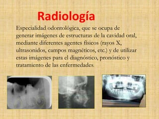 Radiología 
Especialidad odontológica, que se ocupa de 
generar imágenes de estructuras de la cavidad oral, 
mediante diferentes agentes físicos (rayos X, 
ultrasonidos, campos magnéticos, etc.) y de utilizar 
estas imágenes para el diagnóstico, pronóstico y 
tratamiento de las enfermedades. 
 