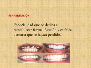 REHABILITACIÓN 
Especialidad que se dedica a 
reestablecer forma, función y estética 
dentaria que se hayan perdido. 
 