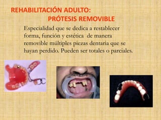 REHABILITACIÓN ADULTO: 
PRÓTESIS REMOVIBLE 
Especialidad que se dedica a restablecer 
forma, función y estética de manera 
removible múltiples piezas dentaria que se 
hayan perdido. Pueden ser totales o parciales. 
 