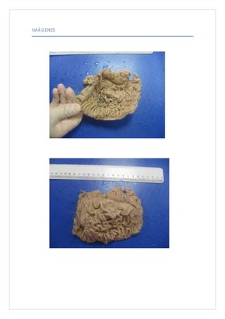 IMÁGENES
 