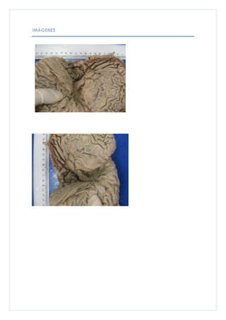 IMÁGENES
 