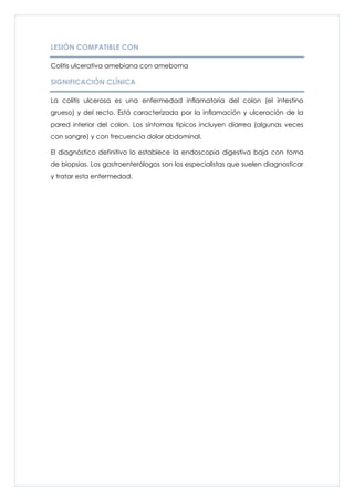 LESIÓN COMPATIBLE CON

Colitis ulcerativa amebiana con ameboma

SIGNIFICACIÓN CLÍNICA

La colitis ulcerosa es una enfermedad inflamatoria del colon (el intestino
grueso) y del recto. Está caracterizada por la inflamación y ulceración de la
pared interior del colon. Los síntomas típicos incluyen diarrea (algunas veces
con sangre) y con frecuencia dolor abdominal.

El diagnóstico definitivo lo establece la endoscopia digestiva baja con toma
de biopsias. Los gastroenterólogos son los especialistas que suelen diagnosticar
y tratar esta enfermedad.
 