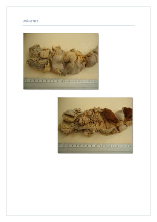 IMÁGENES
 