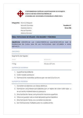 UNIVERSIDAD CATÓLICA SANTIAGO DE GUAYAQUIL
                   FACULTAD DE CIENCIAS MÉDICAS
                   CÁTEDRA DE ANATOMÍA PATOLÓGICA PRÁCTICA



Integrantes: Monica Delgado
             Marcelo Gonzalez                                     Paralelo A1
             Gabriela Merino                                       Ficha #30
             Priscila Pazmiño
             Adriana Romero

TEMA: PATOLOGIAS DE HÍGADO, VÍAS BILIARES Y PÁNCREAS


OBJETIVOS: IDENTIFICAR LAS CARACTERISTICAS MACROSCOPICAS QUE SE
EVIDENCIAN EN CADA UNA DE LAS PATOLOGIAS QUE OCURREN A NIVEL
HEPATICO


ÓRGANO

Segmento de hígado

PESO                                       MEDIDAS

113 g.                                     15 x 6 x 3.7 cm.

SUPERFICIE EXTERNA

   1. Superficie lisa brillante
   2. Color rosado parduzco
   3. Formaciones nodulares quísticas que van de 0.2 a 0.6 cm.

SUPERFICIE INTERNA

   1. Consistencia blanda con áreas elásticas
   2. Formación circunferencial rodeada por un tejido de color café rojizo y
         en el centro material blanco parduzco
   3. Esta formación tiene comunicación hacia la superficie
   4. Otras se quedan solo a nivel del parénquima hepático
   5. Esta formación tiene una consistencia blanda
   6. Son formaciones múltiples pero no coalescentes
 
