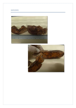 IMÁGENES
 