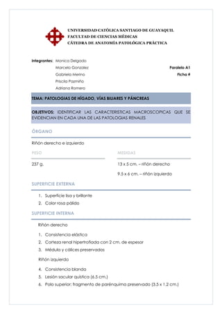 UNIVERSIDAD CATÓLICA SANTIAGO DE GUAYAQUIL
                   FACULTAD DE CIENCIAS MÉDICAS
                   CÁTEDRA DE ANATOMÍA PATOLÓGICA PRÁCTICA



Integrantes: Monica Delgado
            Marcelo Gonzalez                                         Paralelo A1
            Gabriela Merino                                               Ficha #
            Priscila Pazmiño
            Adriana Romero

TEMA: PATOLOGIAS DE HÍGADO, VÍAS BILIARES Y PÁNCREAS


OBJETIVOS: IDENTIFICAR LAS CARACTERISTICAS MACROSCOPICAS QUE SE
EVIDENCIAN EN CADA UNA DE LAS PATOLOGIAS RENALES


ÓRGANO

Riñón derecho e izquierdo

PESO                                      MEDIDAS

237 g.                                    13 x 5 cm. – riñón derecho

                                          9.5 x 6 cm. – riñón izquierdo

SUPERFICIE EXTERNA

   1. Superficie lisa y brillante
   2. Color rosa pálido

SUPERFICIE INTERNA

   Riñón derecho

   1. Consistencia elástica
   2. Corteza renal hipertrofiada con 2 cm. de espesor
   3. Médula y cálices preservados

   Riñón izquierdo

   4. Consistencia blanda
   5. Lesión sacular quística (6.5 cm.)
   6. Polo superior: fragmento de parénquima preservado (3.5 x 1.2 cm.)
 