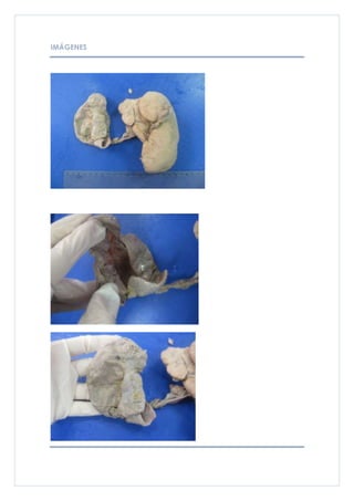 IMÁGENES
 