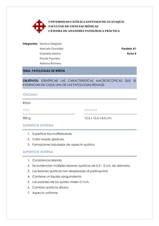 UNIVERSIDAD CATÓLICA SANTIAGO DE GUAYAQUIL
                  FACULTAD DE CIENCIAS MÉDICAS
                  CÁTEDRA DE ANATOMÍA PATOLÓGICA PRÁCTICA



Integrantes: Monica Delgado
           Marcelo Gonzalez                                          Paralelo A1
           Gabriela Merino                                               Ficha #
           Priscila Pazmiño
           Adriana Romero

TEMA: PATOLOGIAS DE RIÑÓN


OBJETIVOS: IDENTIFICAR LAS CARACTERISTICAS MACROSCOPICAS QUE SE
EVIDENCIAN EN CADA UNA DE LAS PATOLOGIAS RENALES


ÓRGANO

Riñón

PESO                                      MEDIDAS

300 g.                                    12.5 x 10.5 x 8.5 cm.

SUPERFICIE EXTERNA

   1. Superficie lisa multilobulada
   2. Color rosado grisáceo
   3. Formaciones lobuladas de aspecto quístico

SUPERFICIE INTERNA

   1. Consistencia blanda
   2. Se evidencian múltiples lesiones quísticas de 0.2 – 2 cm. de diámetro
   3. Las lesiones quísticas han desplazado al parénquima
   4. Contiene un líquido sanguinolento
   5. Las paredes de los quistes miden 0,1cm.
   6. Cambios quísticos difusos
   7. Aspecto uniforme
 