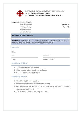 UNIVERSIDAD CATÓLICA SANTIAGO DE GUAYAQUIL
                    FACULTAD DE CIENCIAS MÉDICAS
                    CÁTEDRA DE ANATOMÍA PATOLÓGICA PRÁCTICA



Integrantes: Monica Delgado
              Marcelo Gonzalez                                  Paralelo A1
              Gabriela Merino                                    Ficha # 46
              Priscila Pazmiño
              Adriana Romero

TEMA: PATOLOGIAS DE RIÑÓN


OBJETIVOS: IDENTIFICAR LAS CARACTERISTICAS MACROSCOPICAS QUE SE
EVIDENCIAN EN CADA UNA DE LAS PATOLOGIAS RENALES


ÓRGANO

Riñón

PESO                                         MEDIDAS

119 g.                                       12 x 6.5 x 3 cm.

SUPERFICIE EXTERNA

   1. Superficie externa Lisa brillante
   2. Color rosado- pálido con áreas grisáceas
   3. Degeneración grasa de la pelvis

SUPERFICIE INTERNA

   1. Consistencia blanda – elástica
   2. Dilatación quística sacular de la pelvis (9 cm.)
   3. Desplazamiento de la médula y corteza por la dilatación quística
         (espesor cortical: 1 cm.)
   4. A nivel de los cálices: 6 sáculos (1.5 – 4 cm.)
 