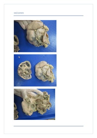 IMÁGENES
 