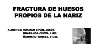 ALUMNOS: HUAMÁN SIPÁN, JESÚS
HUARANGA CUEVA, LUIS
ÑAHUERO YANCES, FIDEL
FRACTURA DE HUESOS
PROPIOS DE LA NARIZ
 