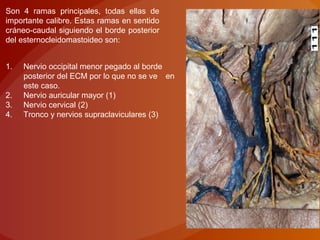 Son 4 ramas principales, todas ellas de
importante calibre. Estas ramas en sentido
cráneo-caudal siguiendo el borde posterior
del esternocleidomastoideo son:
1. Nervio occipital menor pegado al borde
posterior del ECM por lo que no se ve en
este caso.
2. Nervio auricular mayor (1)
3. Nervio cervical (2)
4. Tronco y nervios supraclaviculares (3)
 