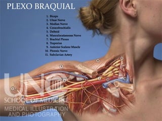 PLEXO BRAQUIAL
 