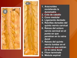 1. Aracnoides
revistiendo la
duramadre
2. Cola de caballo
3. Cono medular
4. Ligamento dentado
5. Raicillas dorsales del
quinto nervio cervical
6. Raíces del octavo
nervio cervical en el
punto en que
penetran en la vaina
dural
7. Raíces del quinto
nervio lumbar en el
punto en que entran
en la vaina dural
8. Filum terminale
9. Médula espinal
 