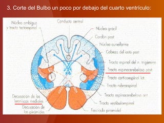 3. Corte del Bulbo un poco por debajo del cuarto ventrículo:
 