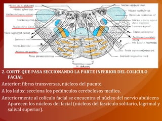 2. CORTE QUE PASA SECCIONANDO LA PARTE INFERIOR DEL COLICULO
FACIAL
Anterior: fibras transversas, núcleos del puente.
A los lados: secciona los pedúnculos cerebelosos medios.
Anteriormente al colículo facial se encuentra el núcleo del nervio abdúcens
Aparecen los núcleos del facial (núcleos del fascículo solitario, lagrimal y
salival superior).
 