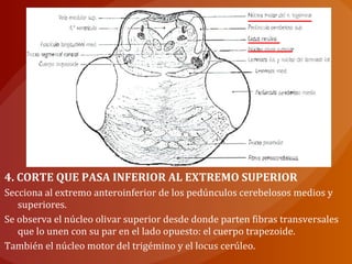 4. CORTE QUE PASA INFERIOR AL EXTREMO SUPERIOR
Secciona al extremo anteroinferior de los pedúnculos cerebelosos medios y
superiores.
Se observa el núcleo olivar superior desde donde parten fibras transversales
que lo unen con su par en el lado opuesto: el cuerpo trapezoide.
También el núcleo motor del trigémino y el locus cerúleo.
 