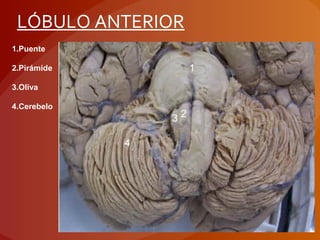 1.Puente
2.Pirámide
3.Oliva
4.Cerebelo
LÓBULO ANTERIOR
 