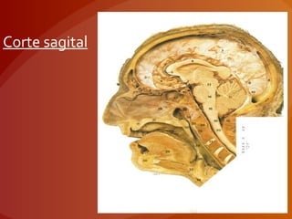 Corte sagital
 