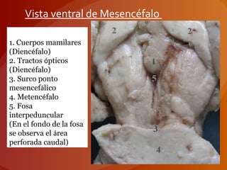 Vista ventral de Mesencéfalo
 
1. Cuerpos mamilares
(Diencéfalo)
2. Tractos ópticos
(Diencéfalo)
3. Surco ponto
mesencefálico
4. Metencéfalo
5. Fosa
interpeduncular
(En el fondo de la fosa
se observa el área
perforada caudal)  
 