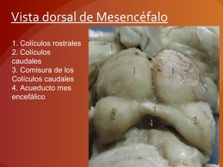 Vista dorsal de Mesencéfalo
1. Colículos rostrales
2. Colículos
caudales
3. Comisura de los
Colículos caudales
4. Acueducto mes
encefálico
 