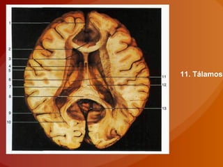 11. Tálamos
 