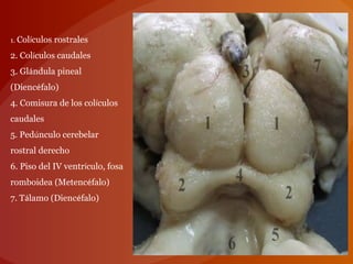 1. Colículos rostrales
2. Colículos caudales
3. Glándula pineal
(Diencéfalo)
4. Comisura de los colículos
caudales
5. Pedúnculo cerebelar
rostral derecho
6. Piso del IV ventrículo, fosa
romboidea (Metencéfalo)
7. Tálamo (Diencéfalo)
 