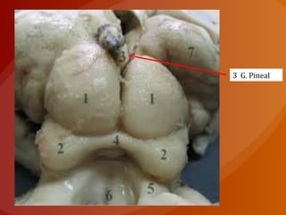 3 G. Pineal
 