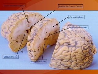 Cisura Interhemisférica
Ventrículos Laterales
Rodilla del Cuerpo Calloso
Corona Radiada
Ganglios Basales
Cápsula Interna
 