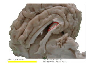 Primer hemisemestre diapositivas