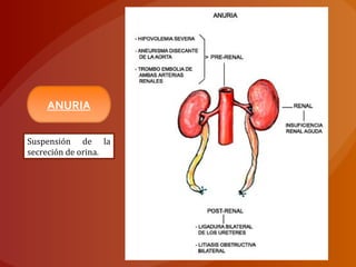 ANURIA
Suspensión de la
secreción de orina.
 
