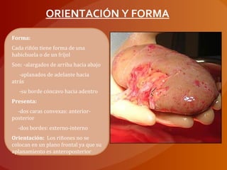 Forma:
Cada riñón tiene forma de una
habichuela o de un fríjol
Son: -alargados de arriba hacia abajo
-aplanados de adelante hacia
atrás
-su borde cóncavo hacia adentro
Presenta:
-dos caras convexas: anterior-
posterior
-dos bordes: externo-interno
Orientación: Los riñones no se
colocan en un plano frontal ya que su
aplanamiento es anteroposterior
ORIENTACIÓN Y FORMA
 