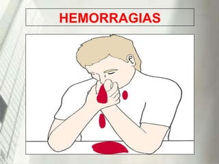 HEMORRAGIAS

19/1/2014

 