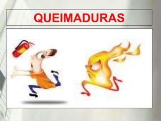 QUEIMADURAS

19/1/2014

 