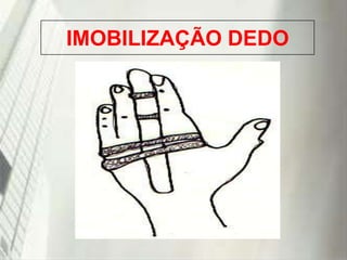 IMOBILIZAÇÃO DEDO

19/1/2014

 