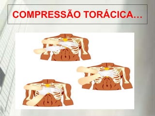 COMPRESSÃO TORÁCICA…

19/1/2014

 