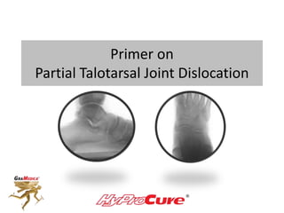 Primer on
Partial Talotarsal Joint Dislocation
 