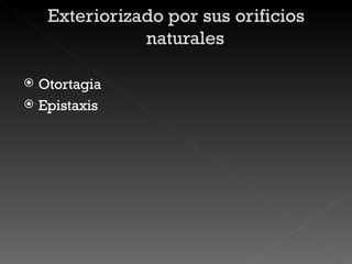 Otortagia Epistaxis 