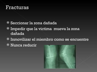 Seccionar la zona dañada Impedir que la victima  mueva la zona dañada Inmovilizar el miembro como se encuentre Nunca reducir  