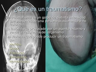 ¿Qué es un traumatismo? Un traumatismo es un golpe de distinta intensidad que puede recibir una persona ocasionando o no lesiones. Es lesión física provocado por un agente externo y vence la resistencia del organismo  Las lesiones que puede producir un traumatismo son: Heridas   Shock Fracturas Hematoma Hemorragias 