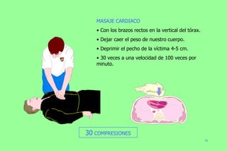 MASAJE CARDIACO Con los brazos rectos en la vertical del tórax. Dejar caer el peso de nuestro cuerpo. Deprimir el pecho de la víctima 4-5 cm. 30 veces a una velocidad de 100 veces por minuto. 30  COMPRESIONES 